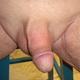 ybnormal17